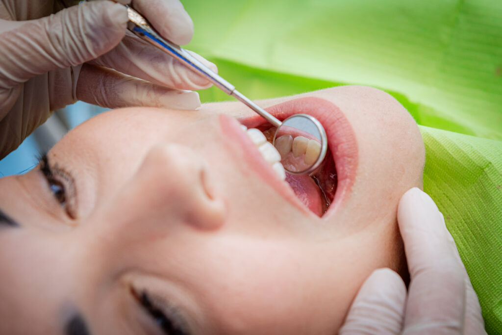 Faccette dentali professionali – il sorriso dei tuoi sogni