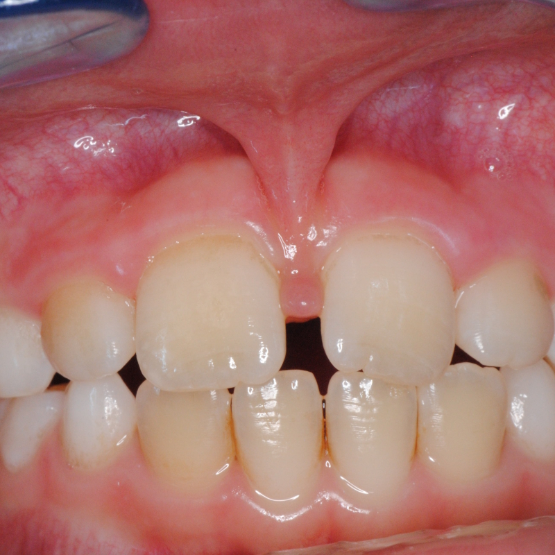 Intervento di chirurgia orale eseguito con precisione e sicurezza