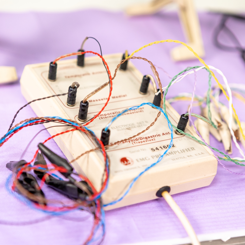 Immagine di trattamento gnatologico – galleria