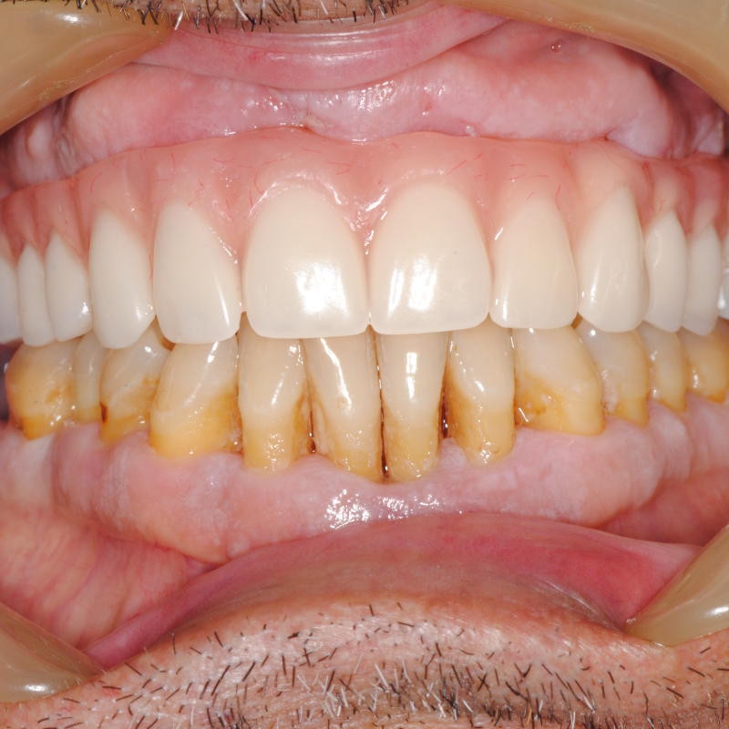 Immagine di implantologia dentale professionale