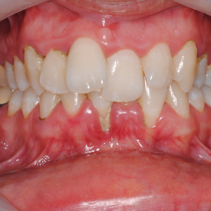 Paziente durante visita ortodontica specialistica a Roma EUR