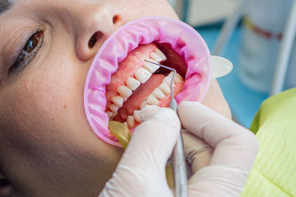 Studio Arena – appuntamento per visita di parodontologia