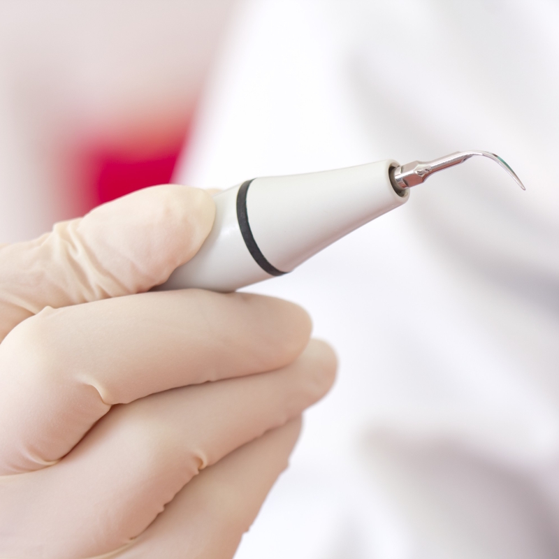 Studio dentistico Arena – benefici dei trattamenti parodontali