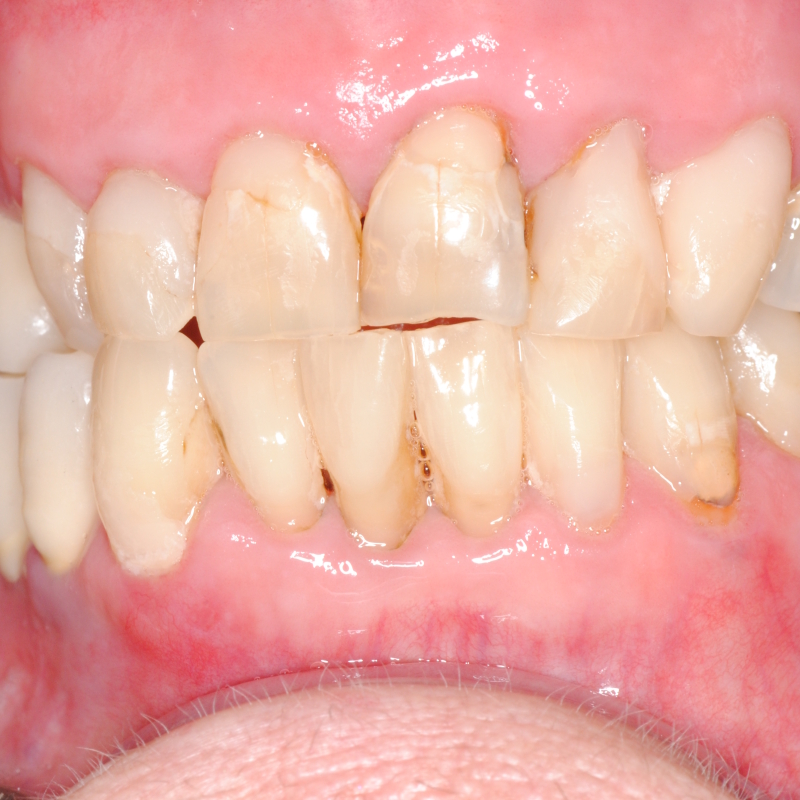 Fase di realizzazione di protesi dentaria in laboratorio odontotecnico