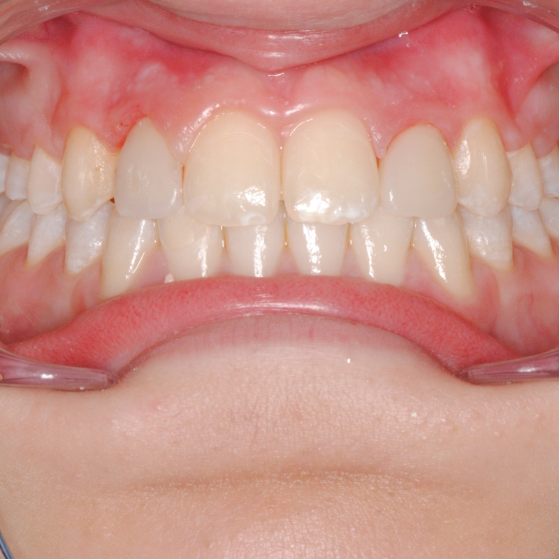 Dentista estetico mostra tecniche di sbiancamento dentale a Roma EUR