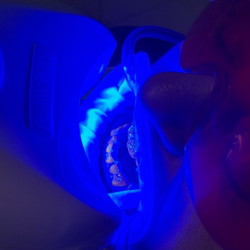 Correzione estetica del sorriso con odontoiatria avanzata a Roma EUR