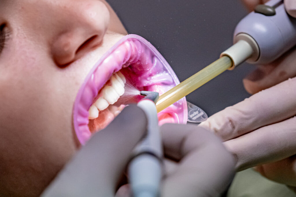 GBT Igiene orale denti sensibili