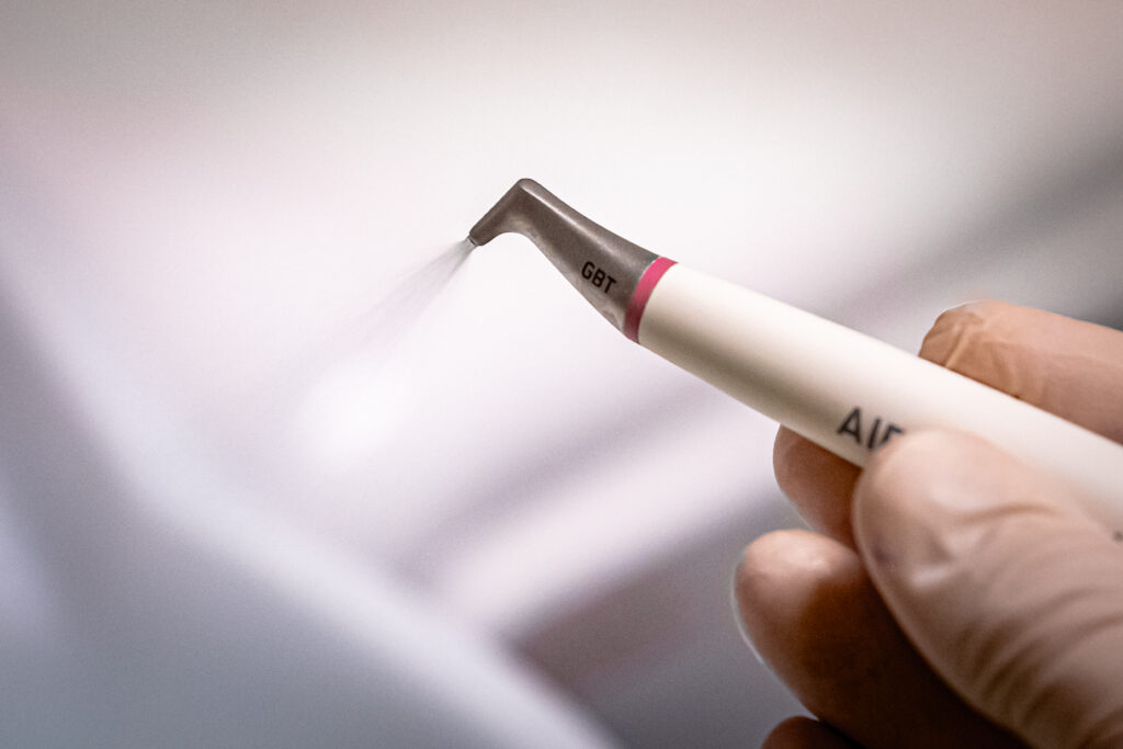 Indolore, senza anestesia, sbiancamento